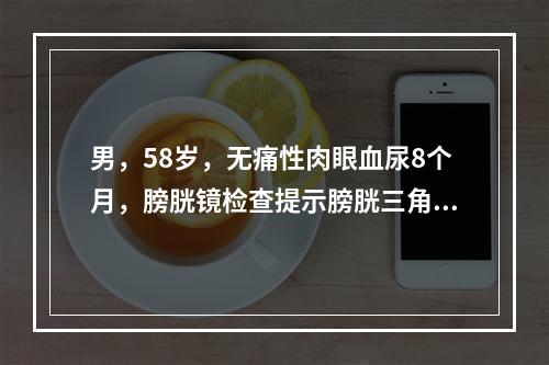 男，58岁，无痛性肉眼血尿8个月，膀胱镜检查提示膀胱三角区右