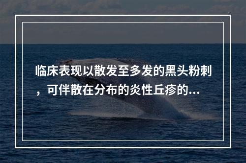 临床表现以散发至多发的黑头粉刺，可伴散在分布的炎性丘疹的痤疮