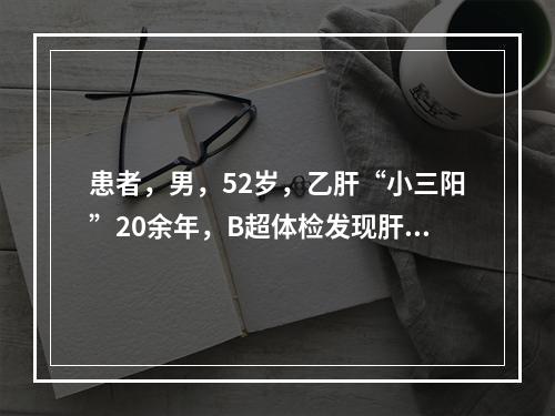 患者，男，52岁，乙肝“小三阳”20余年，B超体检发现肝区结