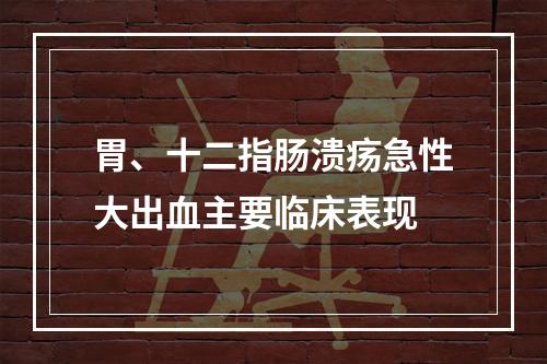 胃、十二指肠溃疡急性大出血主要临床表现