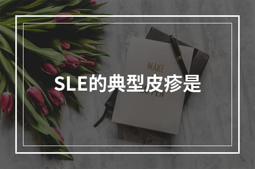 SLE的典型皮疹是