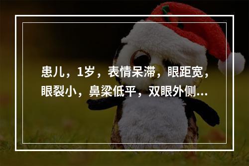 患儿，1岁，表情呆滞，眼距宽，眼裂小，鼻梁低平，双眼外侧上斜