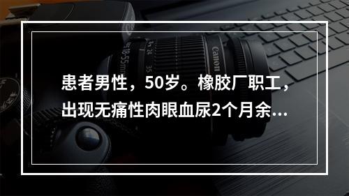 患者男性，50岁。橡胶厂职工，出现无痛性肉眼血尿2个月余，且