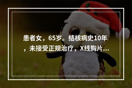 患者女，65岁。结核病史10年，未接受正规治疗，X线胸片示右