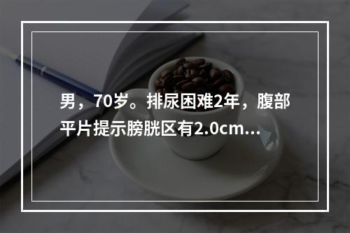 男，70岁。排尿困难2年，腹部平片提示膀胱区有2.0cm椭圆