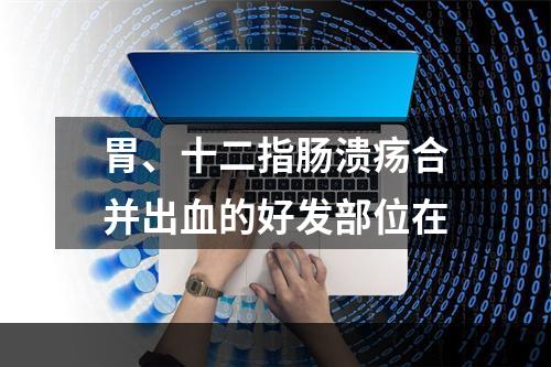 胃、十二指肠溃疡合并出血的好发部位在