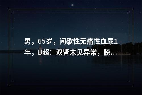 男，65岁，间歇性无痛性血尿1年，B超：双肾未见异常，膀胱右