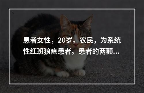 患者女性，20岁。农民，为系统性红斑狼疮患者。患者的两颧及鼻