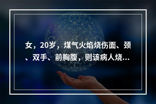 女，20岁，煤气火焰烧伤面、颈、双手、前胸腹，则该病人烧伤面