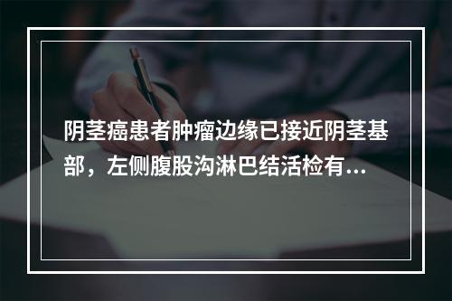 阴茎癌患者肿瘤边缘已接近阴茎基部，左侧腹股沟淋巴结活检有转移