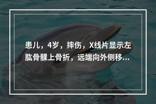 患儿，4岁，摔伤，X线片显示左肱骨髁上骨折，远端向外侧移位，