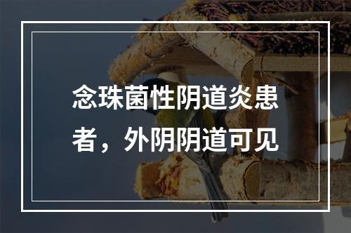 念珠菌性阴道炎患者，外阴阴道可见