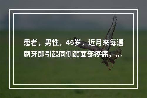 患者，男性，46岁，近月来每遇刷牙即引起同侧颜面部疼痛，需以