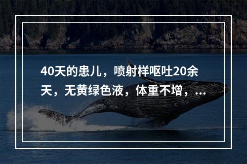 40天的患儿，喷射样呕吐20余天，无黄绿色液，体重不增，大便