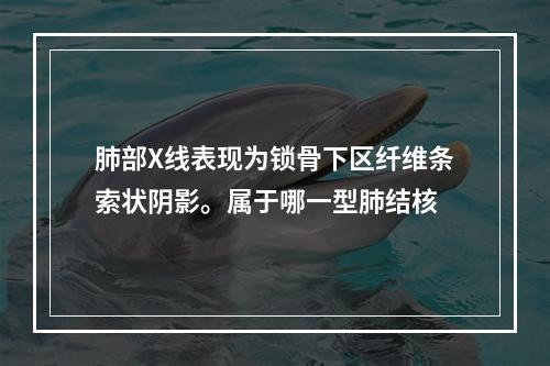 肺部X线表现为锁骨下区纤维条索状阴影。属于哪一型肺结核