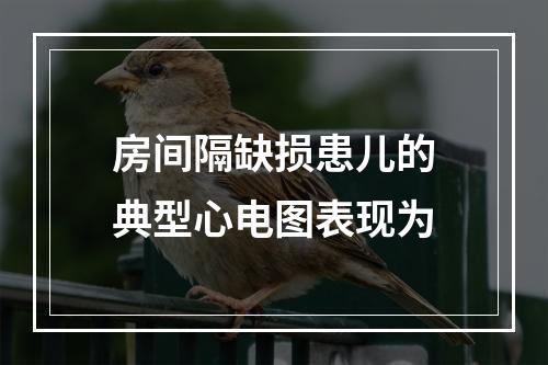 房间隔缺损患儿的典型心电图表现为