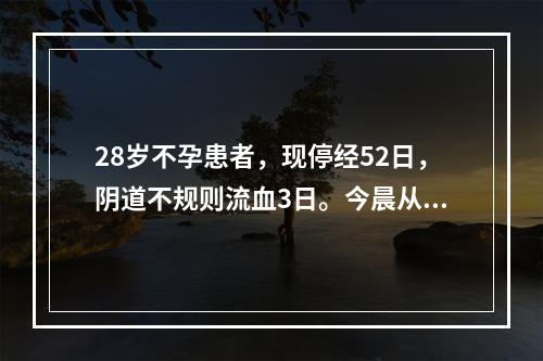 28岁不孕患者，现停经52日，阴道不规则流血3日。今晨从阴道