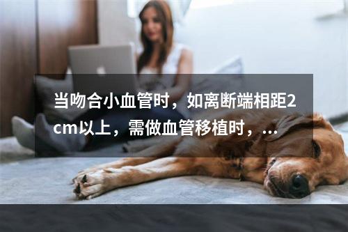 当吻合小血管时，如离断端相距2cm以上，需做血管移植时，最好