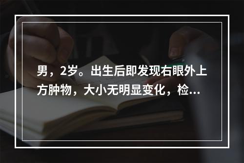 男，2岁。出生后即发现右眼外上方肿物，大小无明显变化，检查发