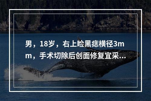 男，18岁，右上睑黑痣横径3mm，手术切除后创面修复宜采用（