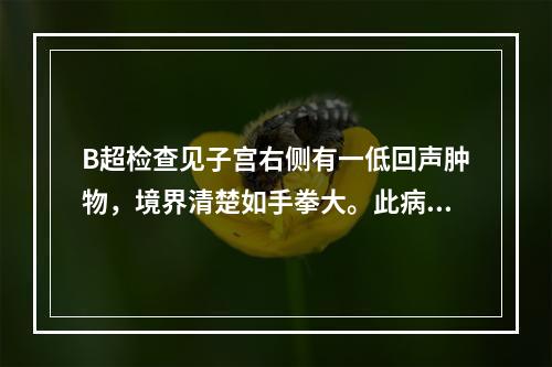 B超检查见子宫右侧有一低回声肿物，境界清楚如手拳大。此病例最