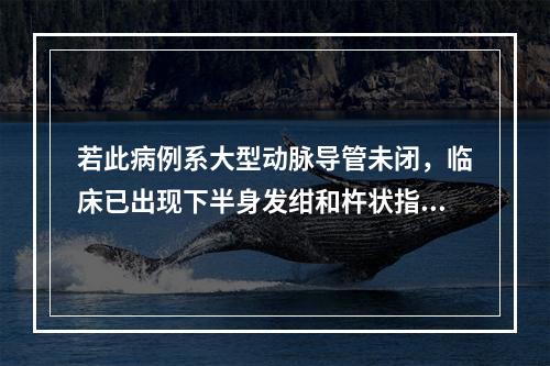 若此病例系大型动脉导管未闭，临床已出现下半身发绀和杵状指。听