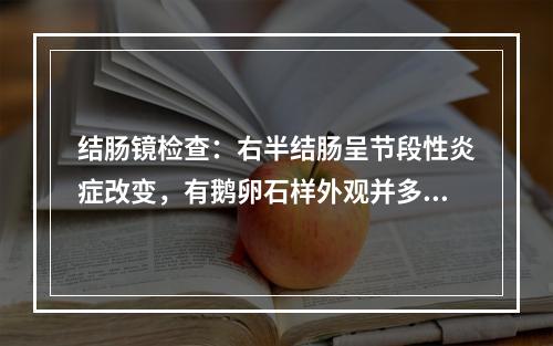 结肠镜检查：右半结肠呈节段性炎症改变，有鹅卵石样外观并多次活