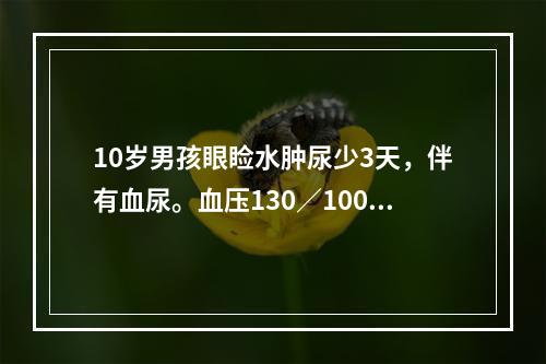 10岁男孩眼睑水肿尿少3天，伴有血尿。血压130／100mm