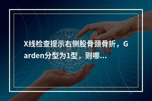 X线检查提示右侧股骨颈骨折，Garden分型为1型，则哪项治