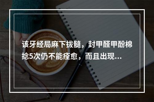 该牙经局麻下拔髓，封甲醛甲酚棉捻5次仍不能痊愈，而且出现咀嚼