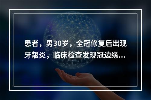 患者，男30岁，全冠修复后出现牙龈炎，临床检查发现冠边缘密合