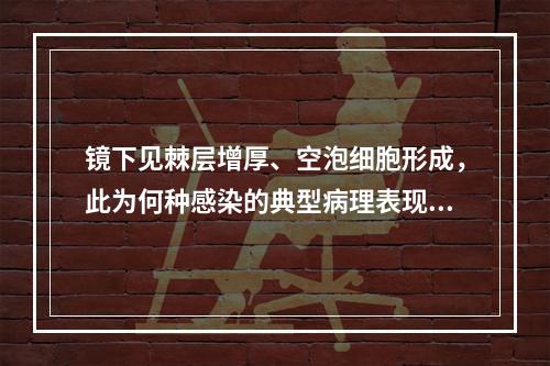 镜下见棘层增厚、空泡细胞形成，此为何种感染的典型病理表现（）