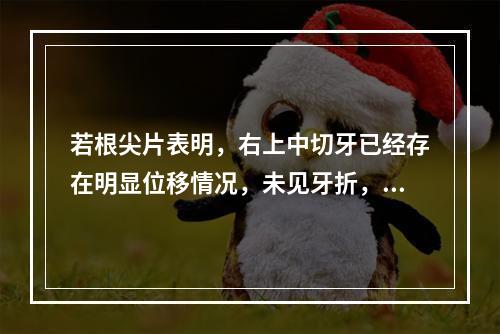 若根尖片表明，右上中切牙已经存在明显位移情况，未见牙折，应采