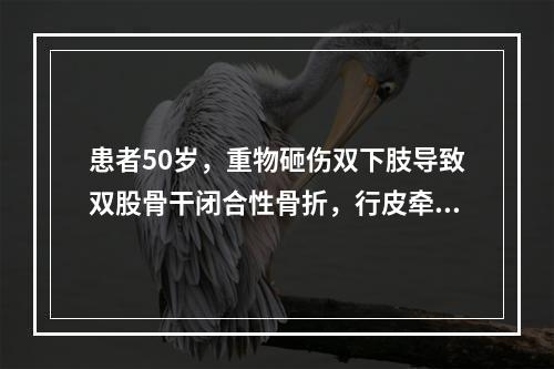 患者50岁，重物砸伤双下肢导致双股骨干闭合性骨折，行皮牵引