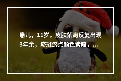 患儿，11岁，皮肤紫癜反复出现3年余，瘀斑瘀点颜色紫暗，间或