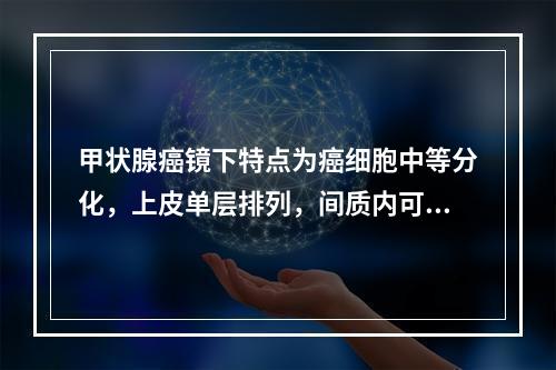 甲状腺癌镜下特点为癌细胞中等分化，上皮单层排列，间质内可见