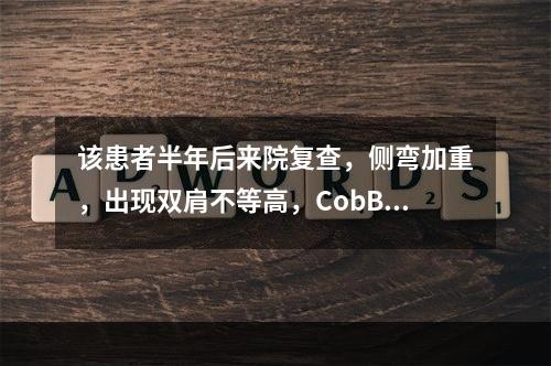 该患者半年后来院复查，侧弯加重，出现双肩不等高，CobB角为