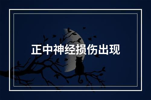 正中神经损伤出现