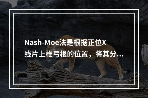 Nash-Moe法是根据正位X线片上椎弓根的位置，将其分为5