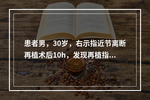 患者男，30岁，右示指近节离断再植术后10h，发现再植指体发