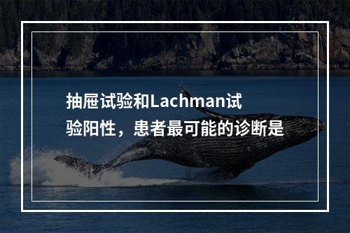 抽屉试验和Lachman试验阳性，患者最可能的诊断是