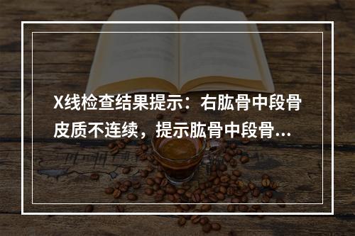 X线检查结果提示：右肱骨中段骨皮质不连续，提示肱骨中段骨折。