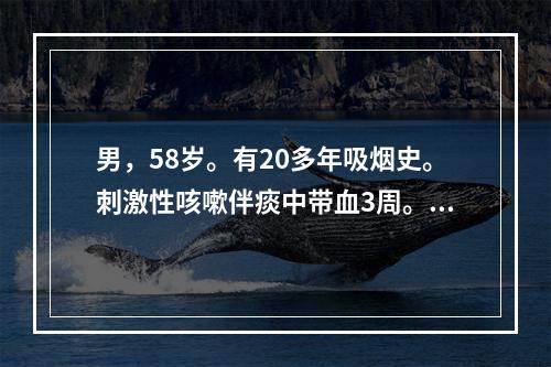 男，58岁。有20多年吸烟史。刺激性咳嗽伴痰中带血3周。胸片