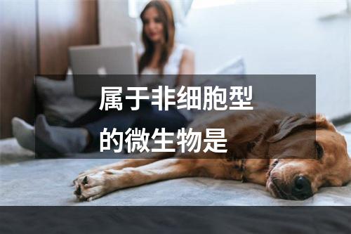 属于非细胞型的微生物是