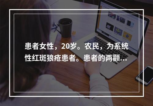 患者女性，20岁。农民，为系统性红斑狼疮患者。患者的两颧及鼻