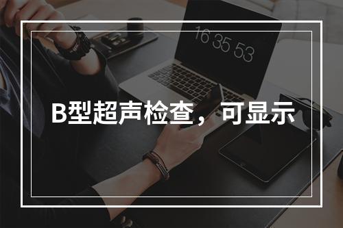 B型超声检查，可显示