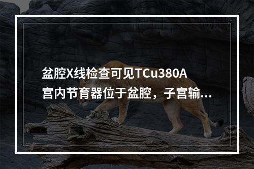 盆腔X线检查可见TCu380A宫内节育器位于盆腔，子宫输卵管