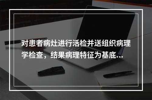 对患者病灶进行活检并送组织病理学检查，结果病理特征为基底层见