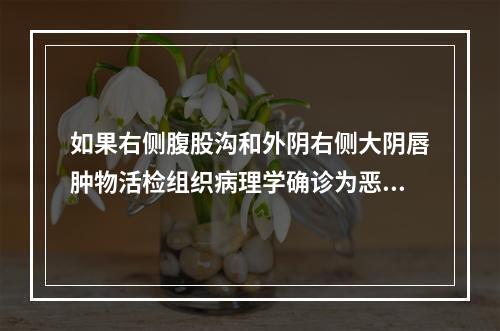 如果右侧腹股沟和外阴右侧大阴唇肿物活检组织病理学确诊为恶性肿