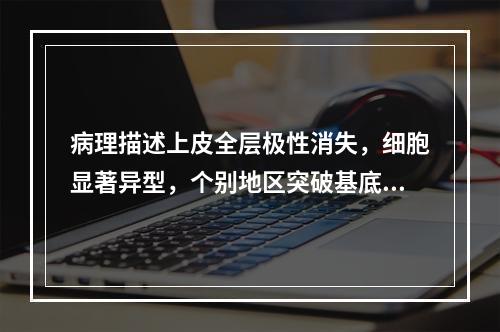 病理描述上皮全层极性消失，细胞显著异型，个别地区突破基底膜，